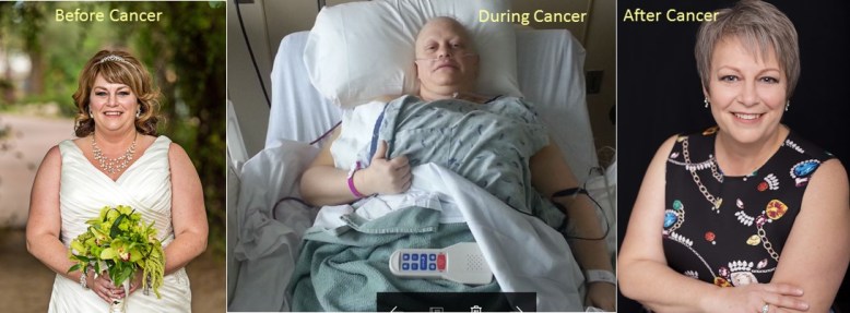 Before During After Cancer